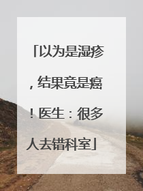 以为是湿疹，结果竟是癌！医生：很多人去错科室